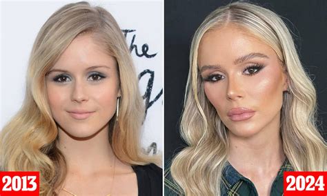 Plastic surgeon reveals procedures Erin Moriarty has。